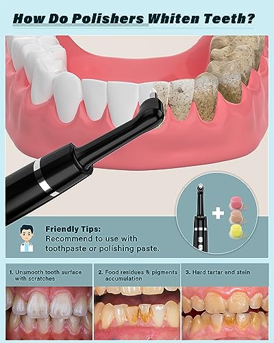 Tooth Polisher, Rechargeable Tooth Whitening Kit for Teeth Cleaning and Whitening, with 3 Tooth Polish Paste and 5 Brush Heads, LED Light, Easy to Use at-Home Personal Dental Care Kit (Black)