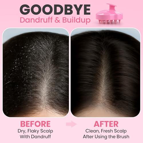 RELAXXO Scalp Massager Hair Growth – Exfoliator & Hair Scrubber for Scalp, Soft Bristles for Dandruff & Soothing Comfort, Shampoo Brush, Wet & Dry Use, Pink