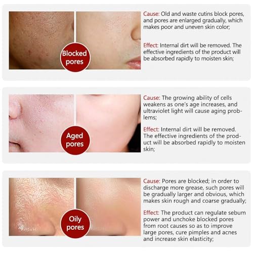LANBENA Pore Skin Care Serum Facial Essence, Minimize Enlarged Pores, for Tightening Pores, Shrinking Pores + Relieving Dryness + Oil Control Firming + Moisturizing (New Packing)