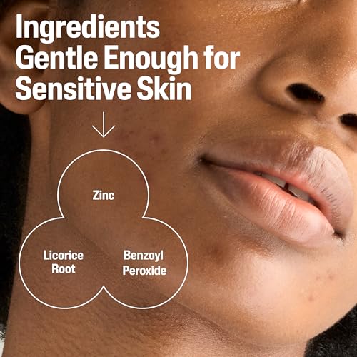 Cetaphil Gentle Clear Complexion-Clearing BPO Acne Cleanser with 2.6% Benzoyl Peroxide, Creamy and Soothing for Sensitive Skin, Suitable for All Skin Types, 4.2oz