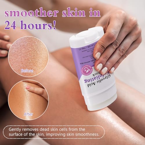 Glycolic Acid Exfoliating Body Stick 75g, Rich in Glycolic Acid, Salicylic Acid & Shea Butter, Smooths Dry & Rough Skin, Gentle Exfoliation, Helps Hydrate, Helps Skin Feel Smoother & More Supple