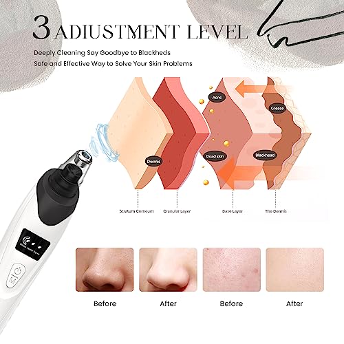 2024 Blackhead Remover Pore Vacuum,Facial Pore Cleaner-5 Suction Power,5 Probes,USB Rechargeable Blackhead Vacuum Kit Electric Acne Extractor Tool for Adult