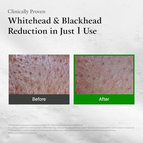 FULLY Green Tomato Clay Mask Cleanser, Cardi B’s Pore Mask Pick for 2-Minute Pore Detox, Blackhead & Sebum Control, 49% Green Tomato Extract, Vegan Fragrance-Free Korean Skincare, 4.05 fl oz