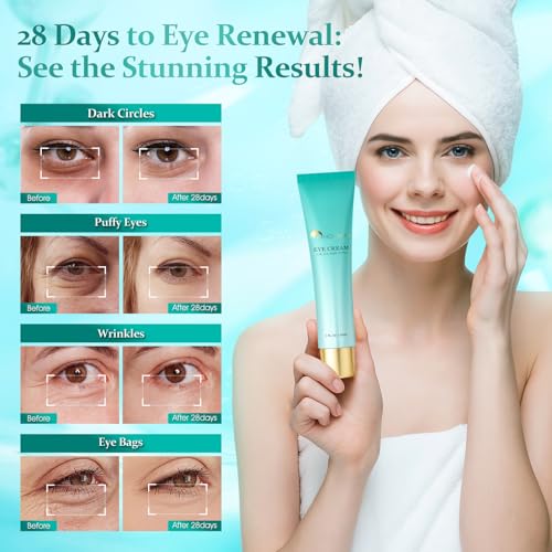 HOLYOM Advanced Eye Cream for Eye bags - Targeted Solution for Puffiness, Wrinkles, Dark Circles, and Firmness - Temporary Firming & Tightening Treatment - Wrinkle Filler, Natural Infusions 1 oz