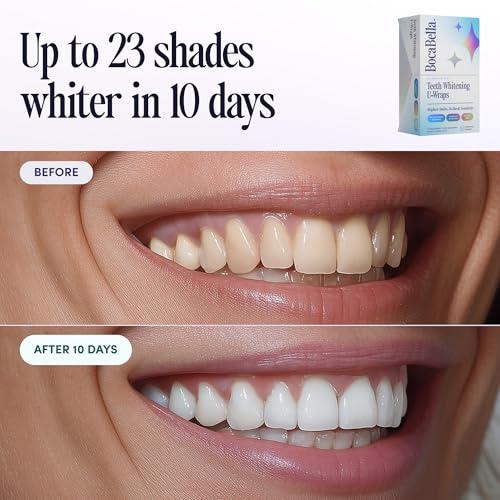Teeth Whitening U-Wraps – 10 Treatments – 15% Hydrogen Peroxide, Enamel-Safe, No Harsh Sensitivity – Patented Strip Design with Aloe, Calendula & Peppermint – Fast, Even Whitening