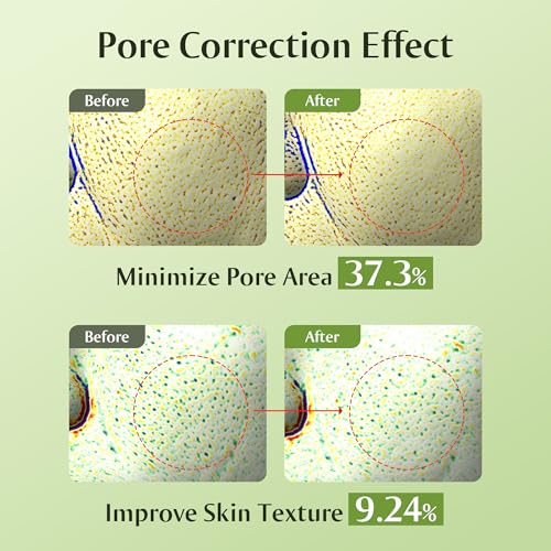 [Redence] 50% Green Grape Water Pore Zero Ampoule 1.01fl.oz/30ml Instant Pore Minimizer & Oil Control For Enlarged Pores & Uneven Texture