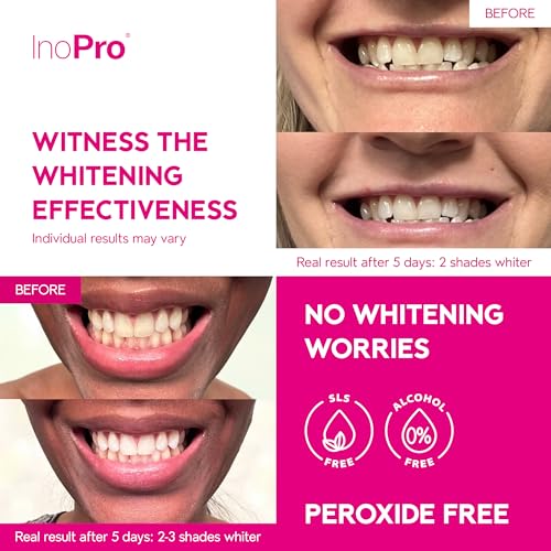 InoPro Teeth Whitening Strips 21 Treatments Kit - Teeth Whitener, Peroxide Free, Green White Strips for Teeth Whitening with Arbutin, Coconut Oil, Deep Stains Removal (42 Strips)