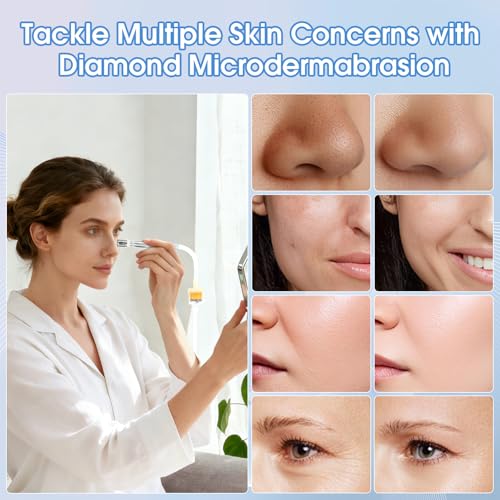 Pro Cordless Microdermabrasion Machine, Beauty Star Portable Facial Pore Vacuum Tool for Blackhead Removal, Glowing Skin, 3 Diamond Tips & 9-Setting Suction, Home and Salon Use