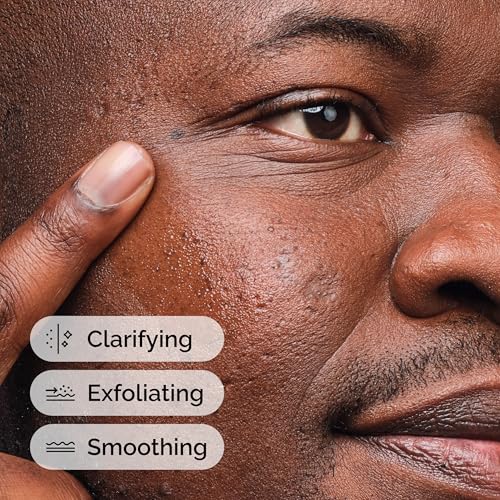 The Ordinary Salicylic Acid 2% Solution, Acne-Fighting Serum for Blemish-Prone Skin