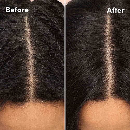 Mizani Scalp Care Calming Scalp Lotion - Soothing Dandruff Treatment, Anti Flake, With Eucalpytus, Avocado Oil & Menthol, Silicone-Free, Paraben-Free